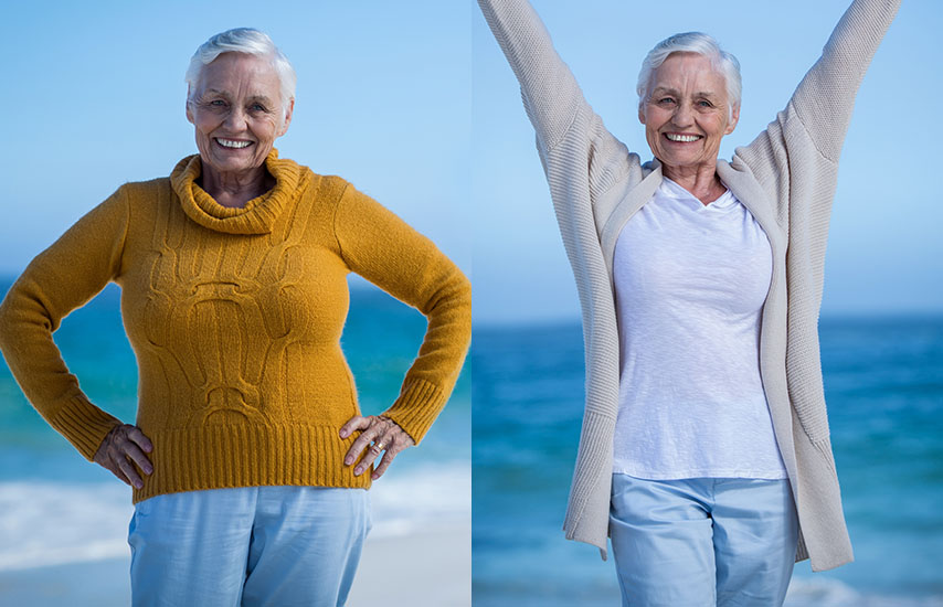 Images of older woman before and after a diet